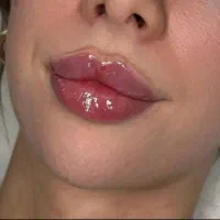 ژل فیلرلب چونه گونه اف ویژه نورامیس کاملا تخصصی|خدمات آرایشگری و زیبایی|زاهدان, |دیوار