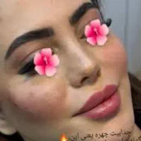 پاکسازی و جوانسازی پوست و صورت .مزو .بوتاکس چربی|خدمات آرایشگری و زیبایی|اسلام‌شهر, شهرک مصطفی خمینی|دیوار