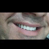 بهدارتجربی دندان و دندانساز|خدمات آرایشگری و زیبایی|بروجرد, |دیوار