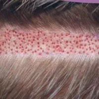 استخدام تکنسین کاشت کار و کات کار|استخدام درمانی، زیبایی، بهداشتی|قم, زنبیل آباد|دیوار