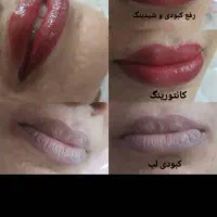 سالن زیبایی کانتورینگ 20٪ تخفیف تمتم لاین ها