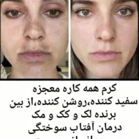 کرم معجزه چهل گیاه اصلی با ضمانت|آرایشی، بهداشتی، درمانی|شیراز, کوشک میدان|دیوار