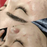 فیشال تخصصی ۳۰٪ تخفیف|خدمات زیبایی و سلامت|تهران, شهرک آزمایش|دیوار