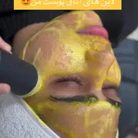 فیشال پاکسازی فیشال تخصصی