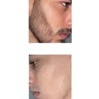 روش جدید بدونه بازگشت