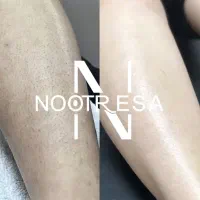 لیزر موهای زائد مرکز لیزر مو در میدان انقلاب تهران|خدمات آرایشگری و زیبایی|تهران, فلسطین (میدان انقلاب)|دیوار