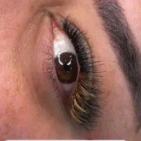 کاشت مژه هیدن