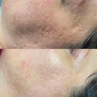 نماینده رسمی باکدصنفی محصولات پوست  ومو فرانسوی