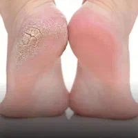 تخفیف ویژه زمستانی اموزش کفسابی و پدیکور حرفه ای