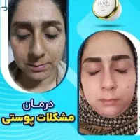 کرم ژل رویال صد در صد تضمینی|آرایشی، بهداشتی، درمانی|شیراز, حافظیه|دیوار