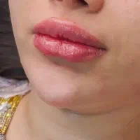 جشنواره پاییزی زیبایی در کلینیک ما آغاز شد...|خدمات آرایشگری و زیبایی|زاهدان, |دیوار