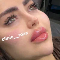 مدل تزریق ژل و بوتاکس کانتورینگ عربی ،لب روسی|خدمات آرایشگری و زیبایی|کرج, گوهردشت|دیوار