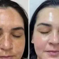 سال1405به استقبال پوست روشن جوان بشتاب