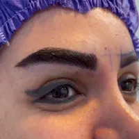 پکیج اقتصادی کاشت دائمی مو، ابرو و ریش