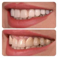 دستیار دندان پزشک