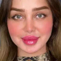 50%تخفیف تزریق ژل وبوتاکس وفیلر بادی در مطب پزشک