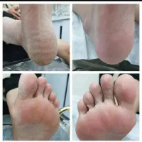 مدل برای پاکسازی وکفسابی وسیاهی قوزک پا ودست.خانم