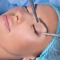 بلفاروپلاستی و اتوپلاستی گوش