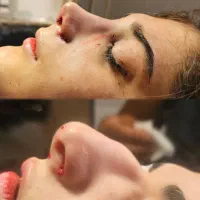 اف .عمل دماغ بینی۲۵ت دراهوازتااخرهفته