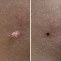 مشاوره تخصصی ویروسهای خاص بدن (مشاوره محرمانه)|آرایشی، بهداشتی، درمانی|گنبد کاووس, |دیوار