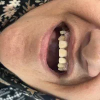 خدمات دندانسازی مروارید|خدمات آرایشگری و زیبایی|دهدشت, |دیوار