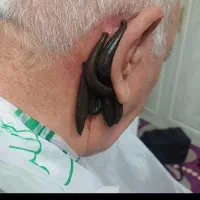 حجامت بادکش گرم فصد خون زالو درمانی مزاج شناسی|خدمات زیبایی و سلامت|تهران, شمسآباد|دیوار