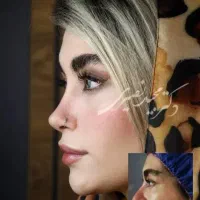 جوانسازی صورت با اقساط ویژه بدون پیش پرداخت