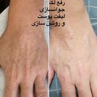 فیشال فقط ۳۵۰ (پاکسازی پوست) حرفه ای به مدت محدود|خدمات آرایشگری و زیبایی|صدرا-فارس, فاز ۱|دیوار