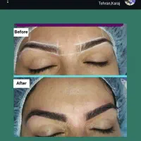 کاشت مو ابرو بلفاروپلاستی مزو تراپی پی آرپی|خدمات آرایشگری و زیبایی|تهران, صادقیه|دیوار