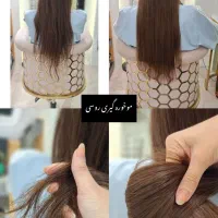 موخوره گیری/کات لیزری/با تخفیف