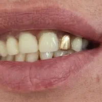 دندانسازی بانو دنت.با چک|خدمات آرایشگری و زیبایی|تربت‌حیدریه, داروپخش|دیوار