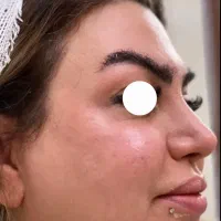 مژده مژده به عروس خانمها گل فیشیال عروس فقط 350|خدمات آرایشگری و زیبایی|اصفهان, خانه اصفهان|دیوار