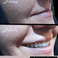 دندانسازی دندان سازی دندان مصنوعی پروتز|خدمات آرایشگری و زیبایی|مشهد, ولیعصر (امامیه)|دیوار