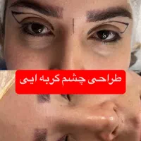 جراحی پلک چشم گربه ایی لیزری با پنج میلیون و پونصد