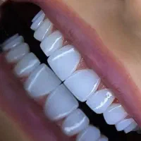 خدمات تخصصی دندانپزشکی و ایمپلنت