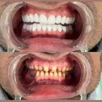 دندان پزشکی|خدمات آرایشگری و زیبایی|کرمانشاه, |دیوار