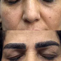 بلفاروپلاستی|خدمات آرایشگری و زیبایی|ارومیه, |دیوار