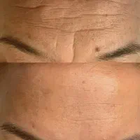 کرم بیو ممتیک ۵ کاره