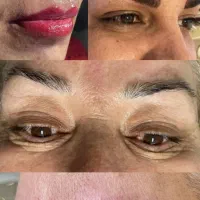 خدمات زیبایی تخصصی‌میکروبلیدینگ