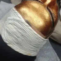 بمب تخفیفات خدمات تخصصی پوست در مطب آقایان و خانم