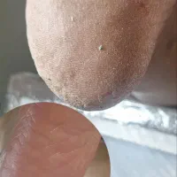 کاشت و ترمیم ناخن دست و پا، پدیکور و کفسابی