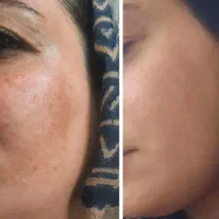 کرم بیوممتیک ضد لک پنج کاره