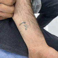 لیزر تتو وروشن کننده بدن|خدمات آرایشگری و زیبایی|پاکدشت, پاکدشت (مامازند)|دیوار