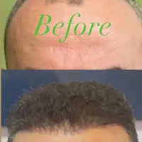 کاشتمو/ابرو/ریش