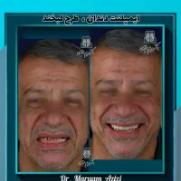 مرکز تخصصی ایمپلنت دندانپزشکی شیراز / تعرفه دولتی