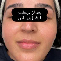فشیال تخصصی وفوق تخصصی این هفته باتخفیف ویژه