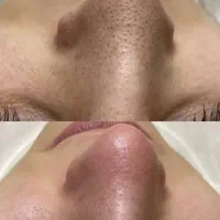 پاکسازی پوست