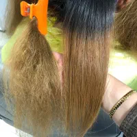 پروتئین تراپی بوتاکس تراپی پلکس تراپی