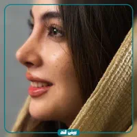 جشنواره تخفیفات جراحی بینی / عمل بینی