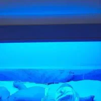 اجاره روزانه دستگاه فتوتراپی درمان زردی نوزاد